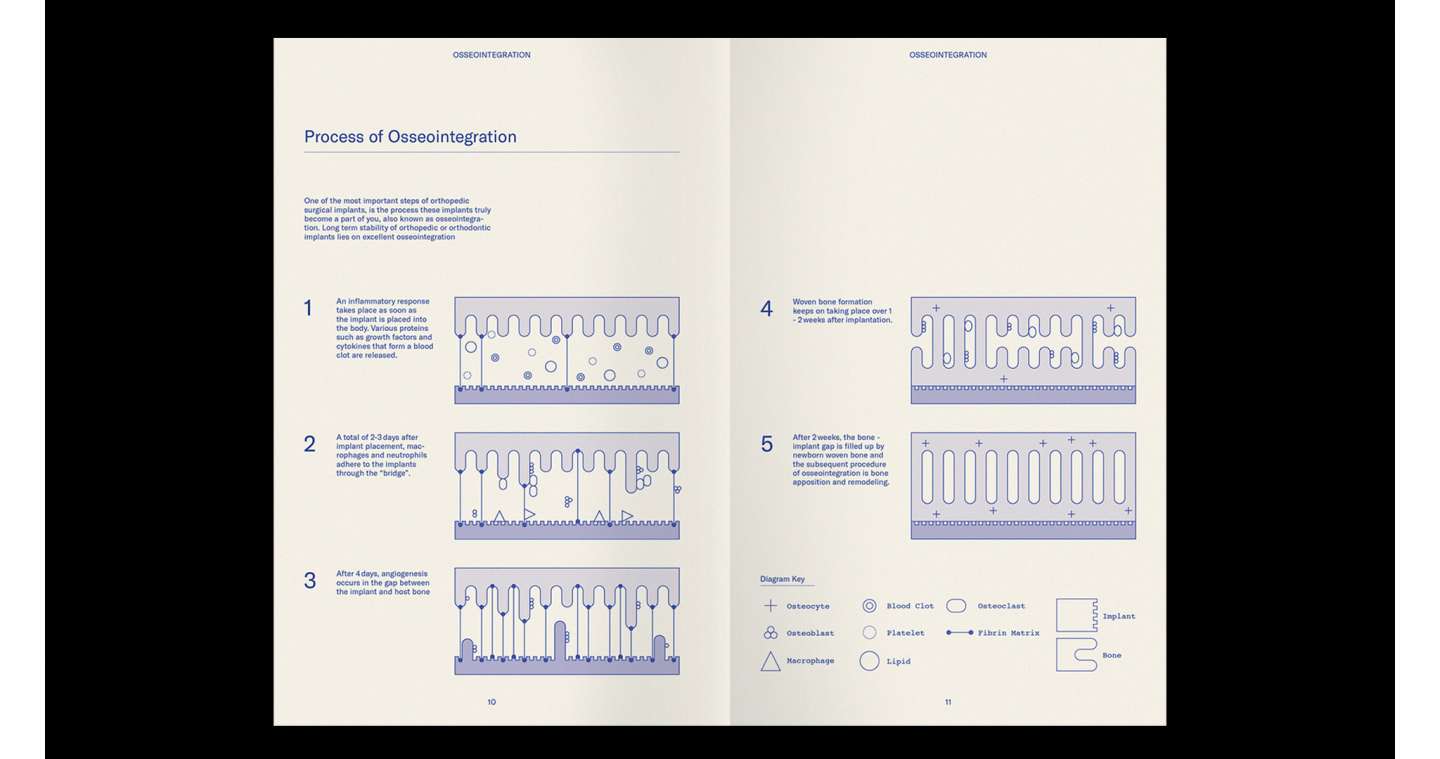 Osseointegration