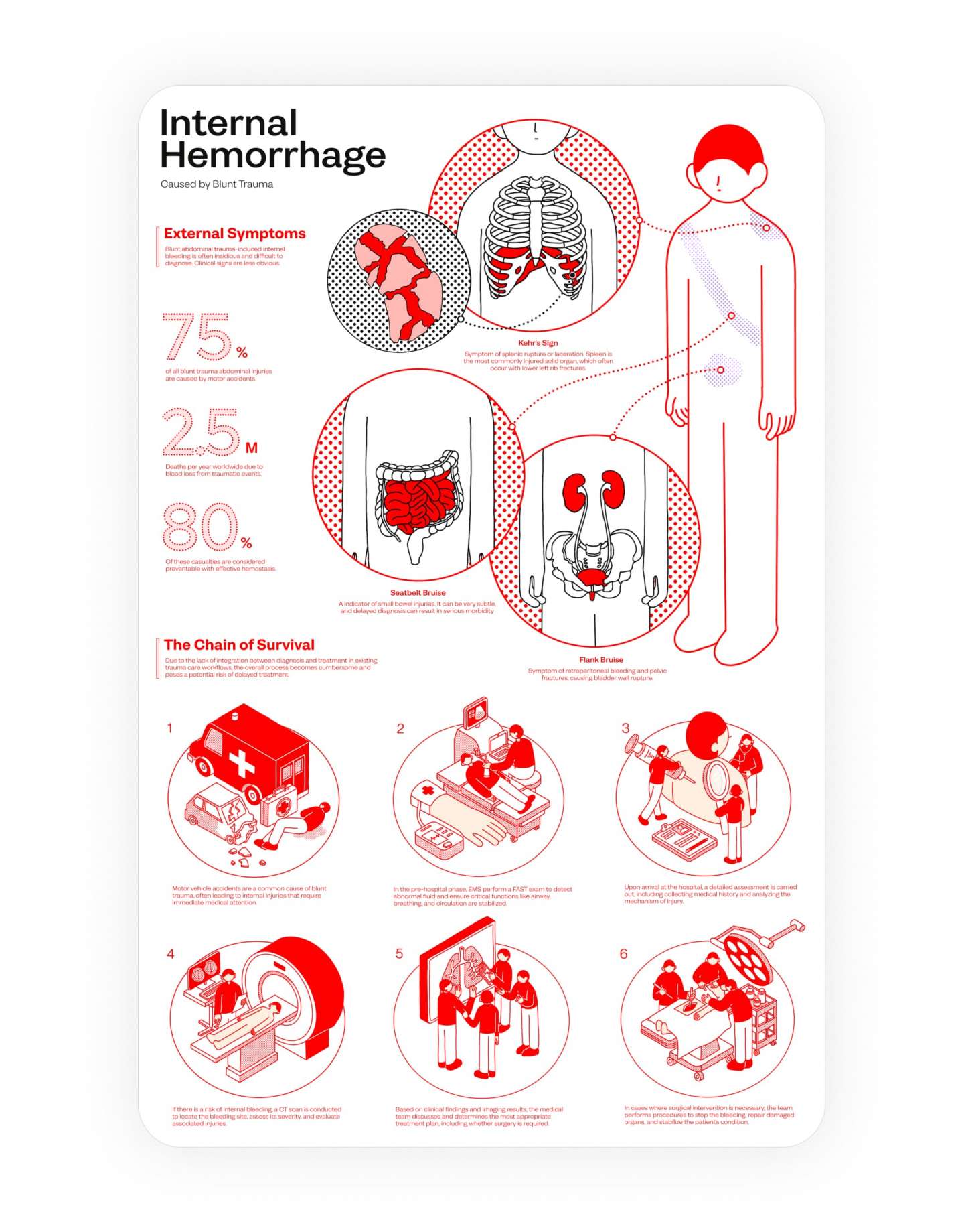 Internal Hemorrhage From Blunt Trauma