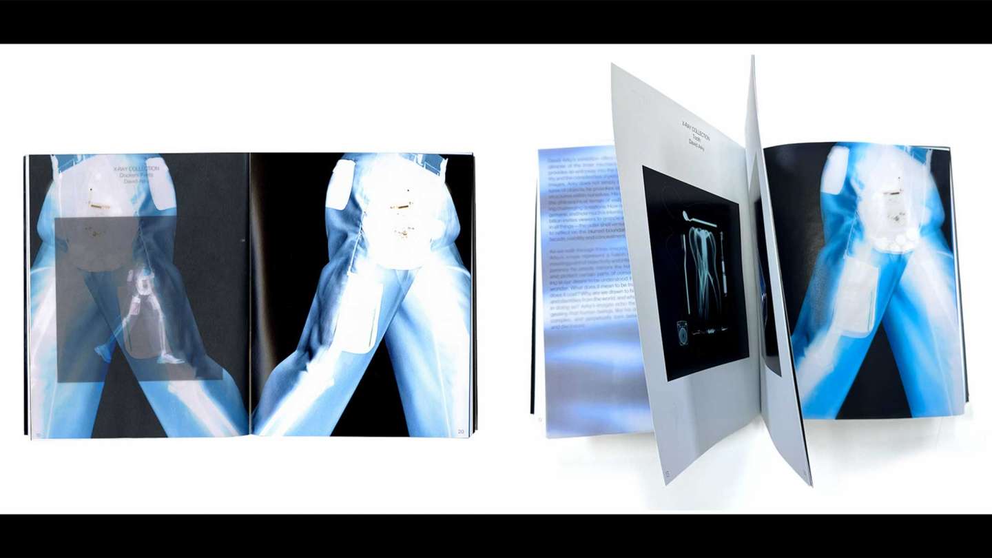 Underneath The X-Ray