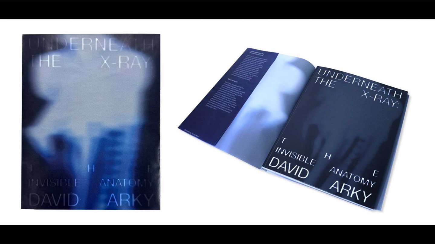 Underneath The X-Ray